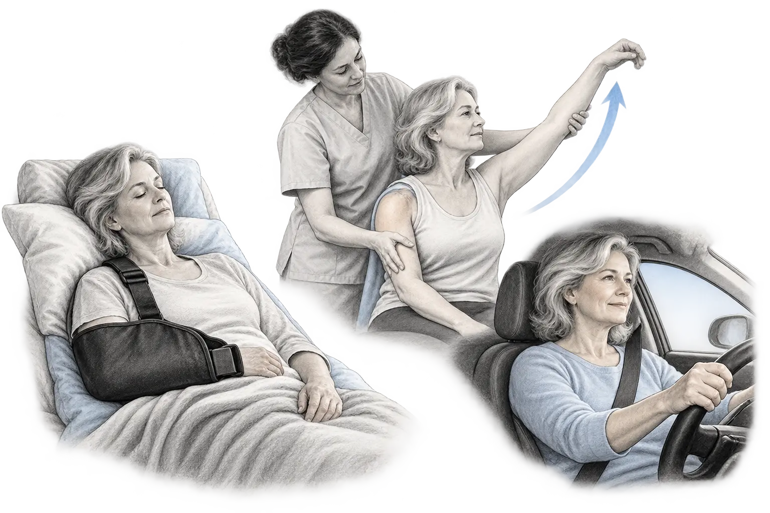 Sommeil, kinésithérapie et conduite après prothèse d’épaule