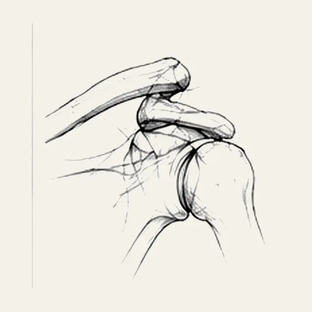 Disjonction acromio-claviculaire