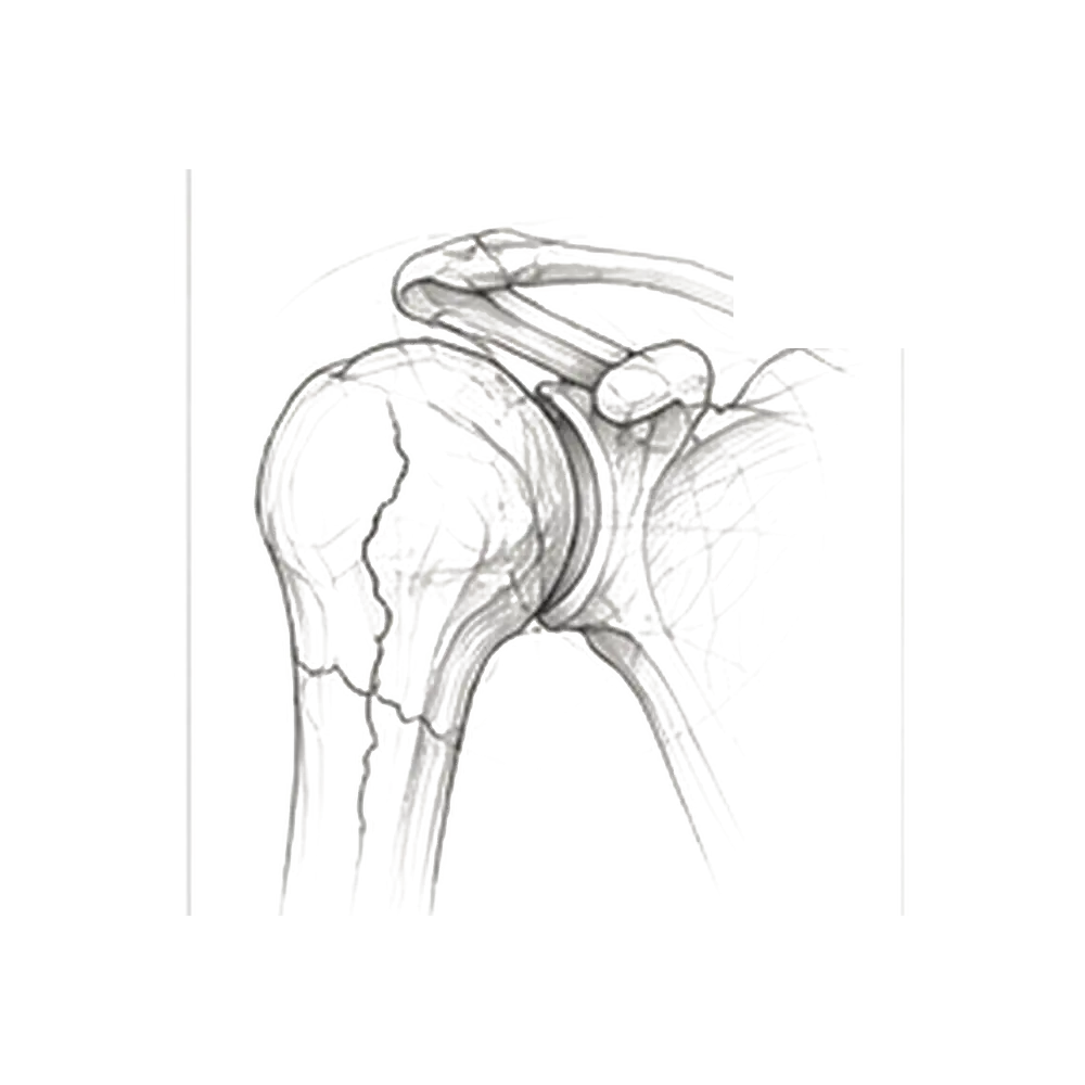 Traumatologie de l’épaule